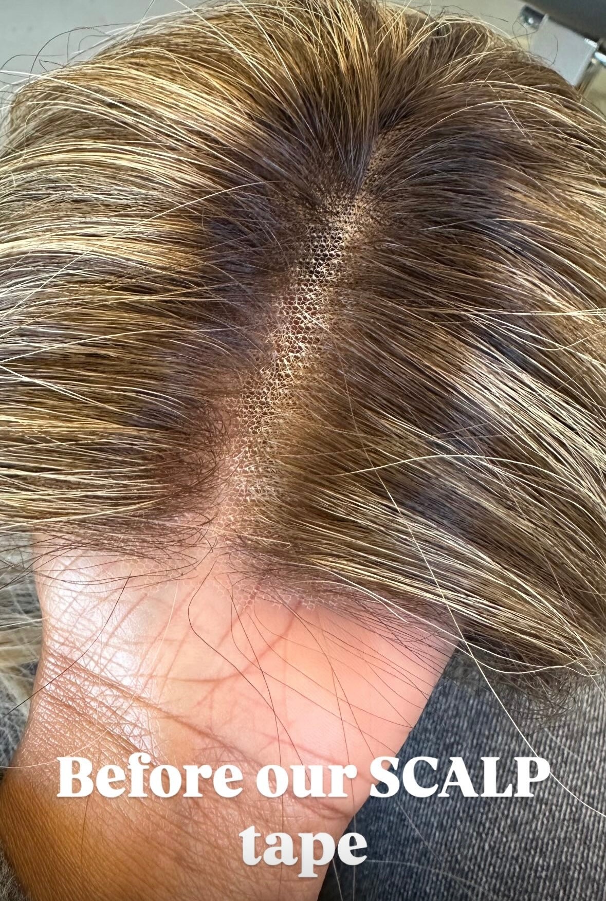 SCALP - (WIG TAPE)