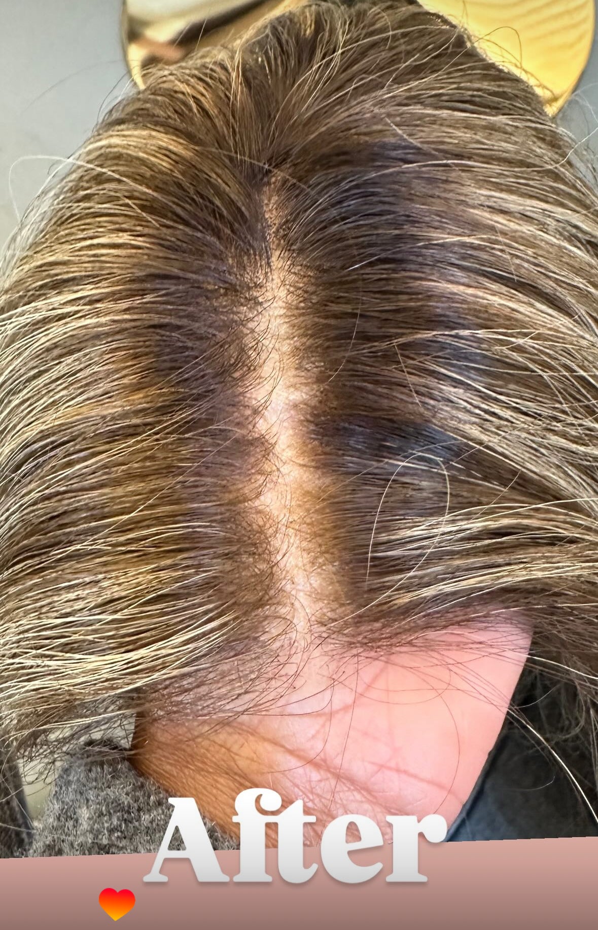 SCALP - (WIG TAPE)